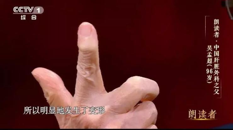 美敦力“雨果”机器人辅助手术系统首次用于妇科手术