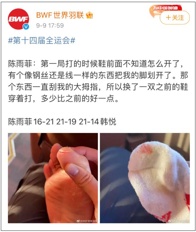 陈雨菲全运会比赛中脚被割伤,陈雨菲穿李宁鞋比赛脚被割伤