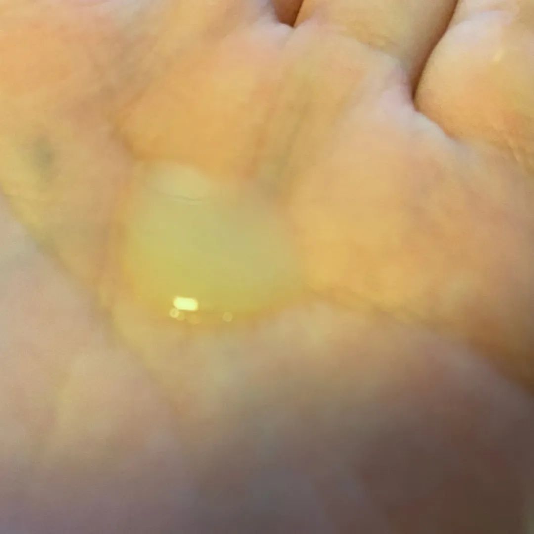 drjart蒂佳婷新包装,drjart蒂佳婷蓝色胶囊安瓶测评