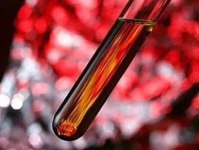 肾脏病肌酐高吃什么能降肌酐,慢性肾衰竭肌酐怎么降下来