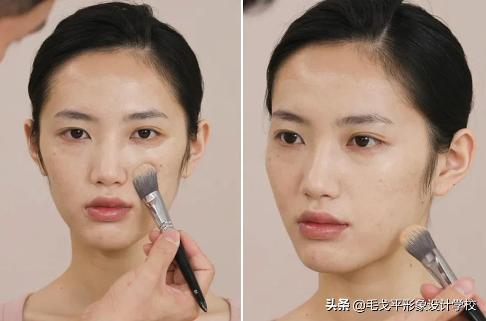 后期如何提升脸部平整度,凹陷脸如何变饱满