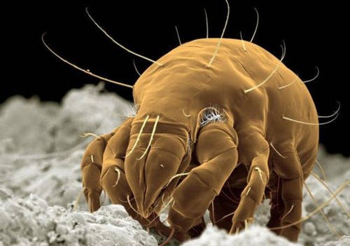 头皮上抠出白皮是头皮屑吗,头皮屑白泥是什么