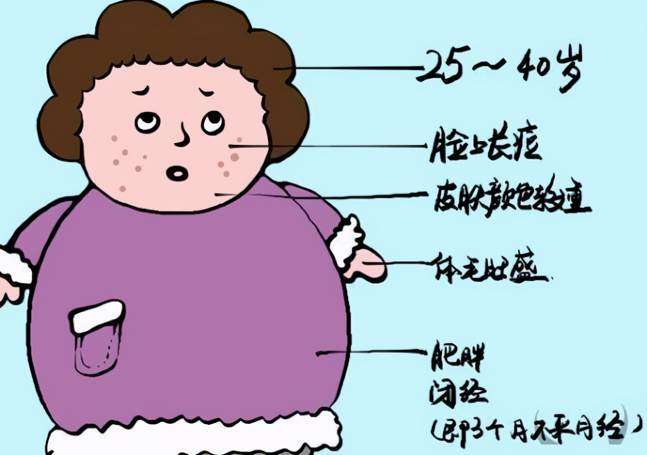 女生长胡子什么原因怎么解决,女生长胡子是什么原因怎么消掉