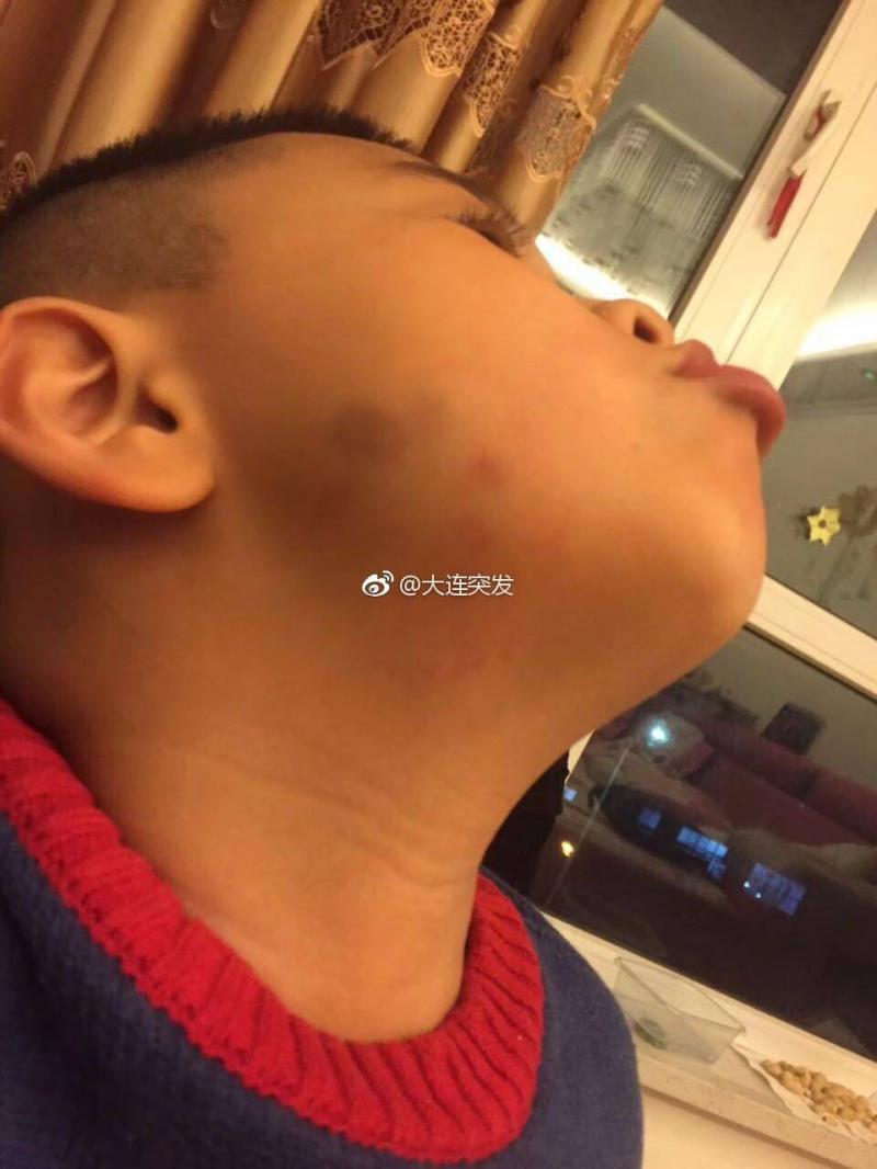 官方通报幼儿园老师殴打孩子,幼儿园老师殴打学生最新处理结果