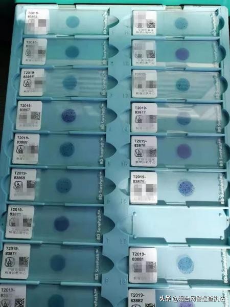 女子被猫抓了一下,五岁女孩被猫抓了一下