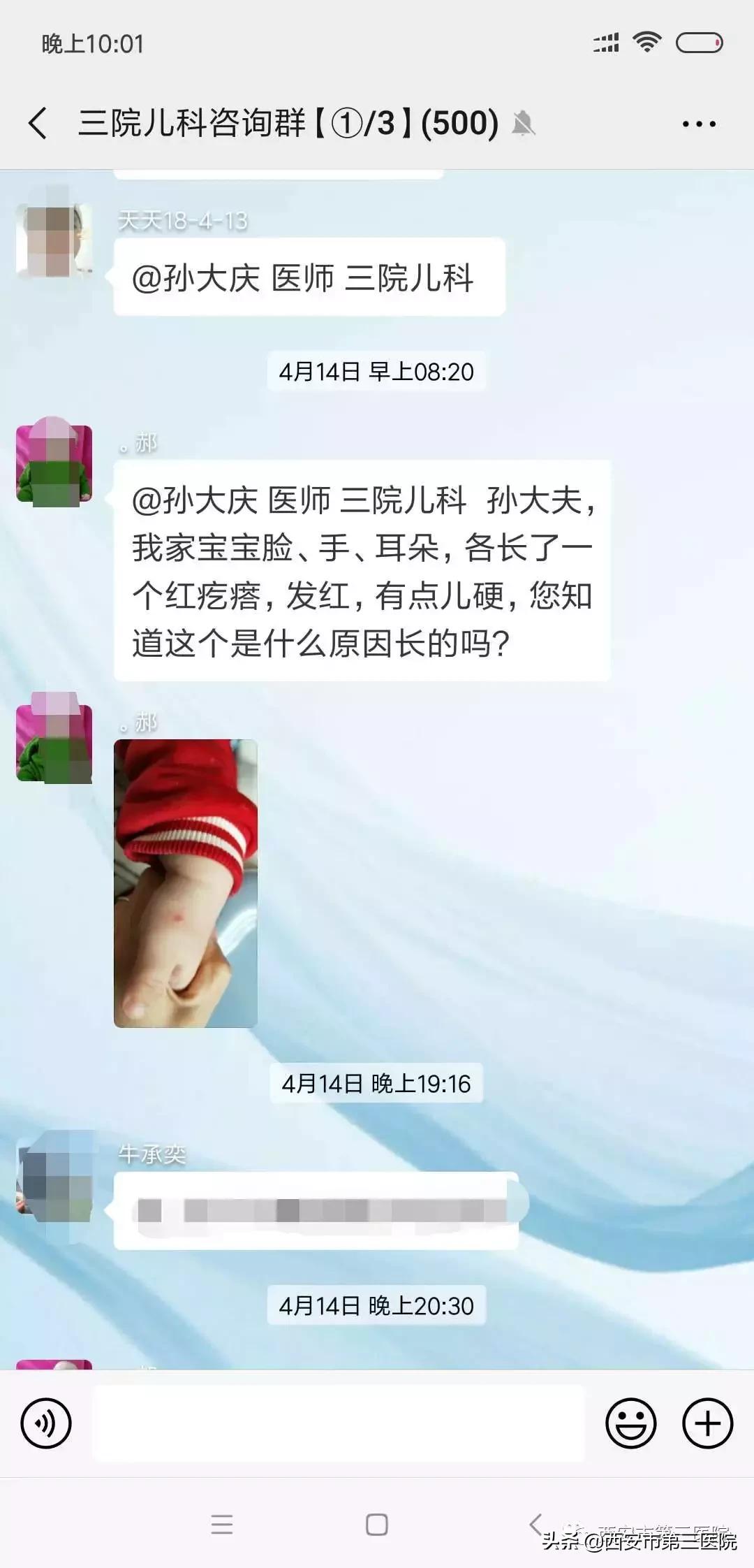 宝宝手足口病腿上都是红点点,宝爸宝妈刚看小孩子的表现