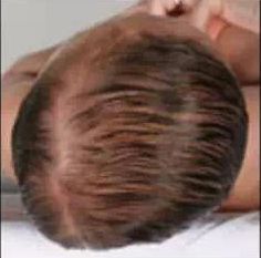 颅顶高扁头怎么睡成圆头,如何拯救高颅顶大扁头