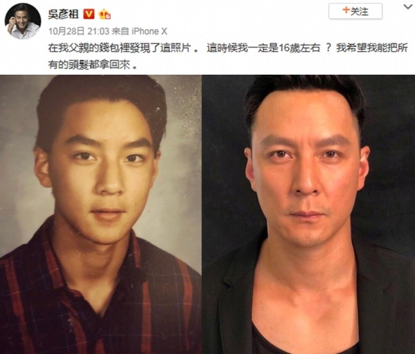 小贝上央视新闻,小贝秃头照