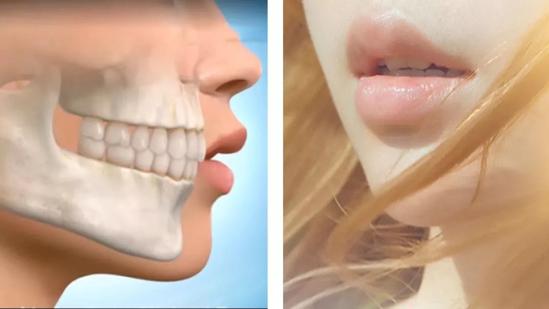 蔡徐坤整牙前图片,蔡徐坤整牙前后照片