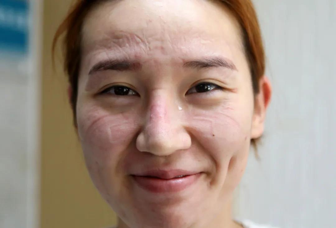 市新冠定点救治医院,探访新冠重症救治一线人员