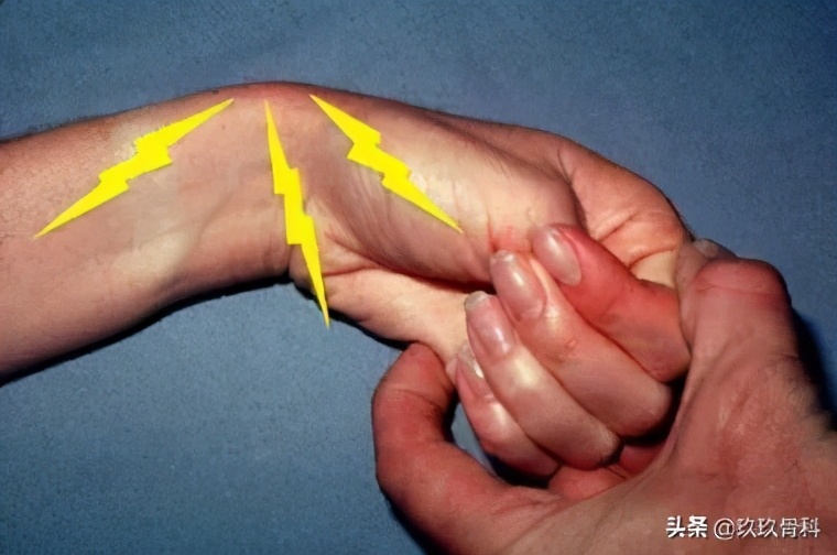 做家务手腕突然酸痛怎么缓解,手腕疼做运动时怎么保护