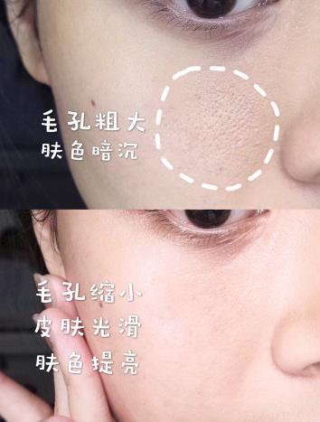 张俪推荐的保湿精华,张俪美白淡斑精华