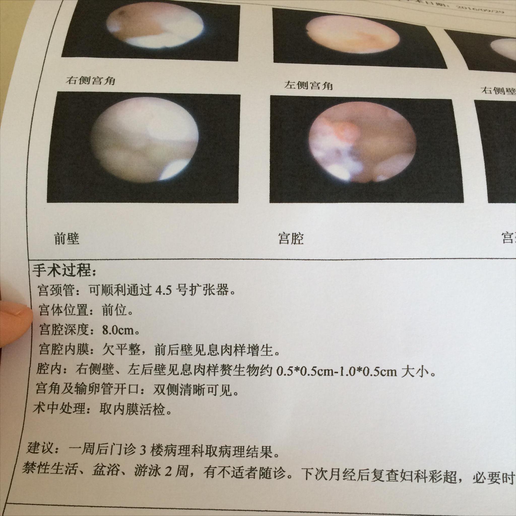 结节息肉囊肿增生哪个更容易癌变,结节囊肿增生息肉有什么区别