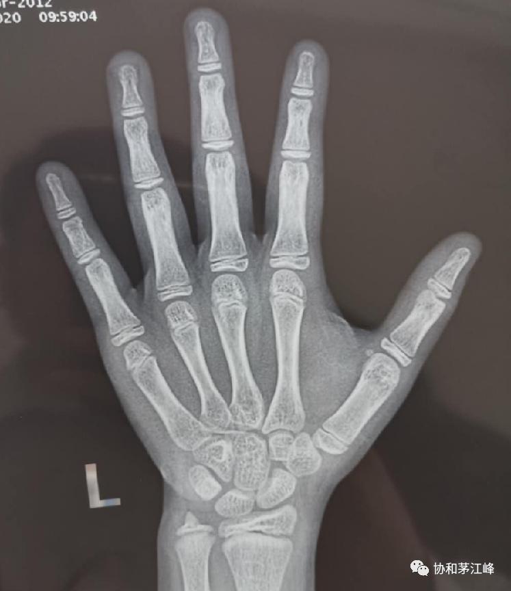 双打快速提升小技巧,双打加强训练