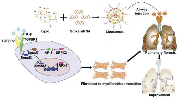 基因干细胞能治疗肺纤维化吗,基因干细胞能治好肺纤维化吗