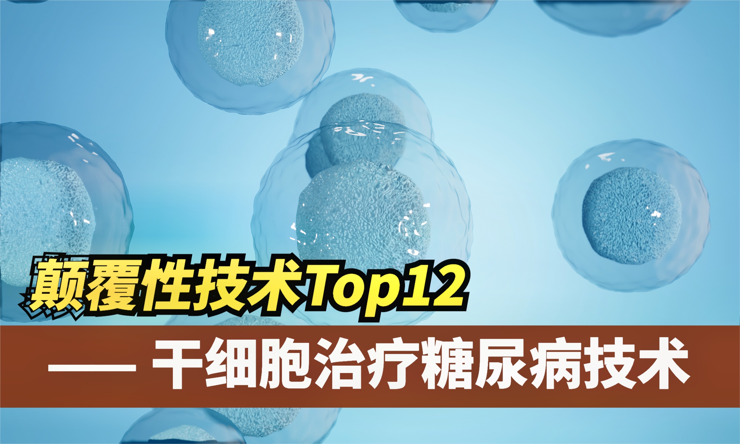 最新干细胞治疗糖尿病,世界干细胞治疗糖尿病最新成果