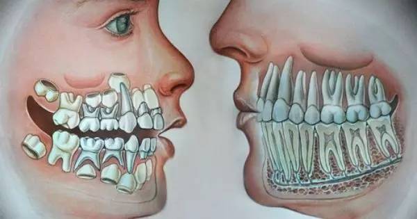孩子换牙期不要忽略这些问题,孩子要换牙该注意什么