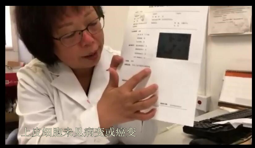 宫颈癌筛查tct意义不明确咋回事,宫颈癌筛查tct检查有炎症上什么药