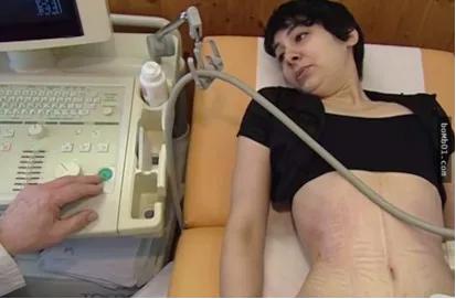 “内脏下垂、子宫脱落、漏尿……”：扒一扒你不知道的网红束腰