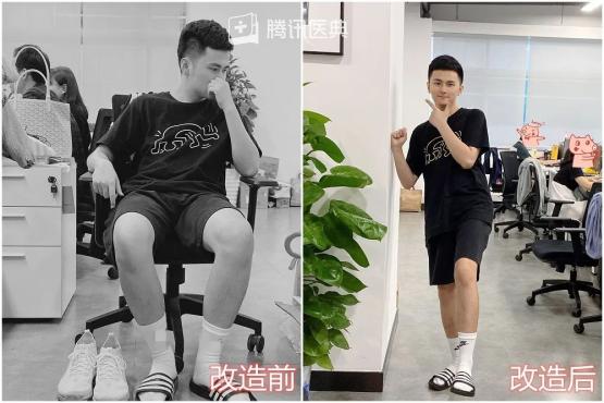 27岁男生脚臭,年轻小伙脚臭