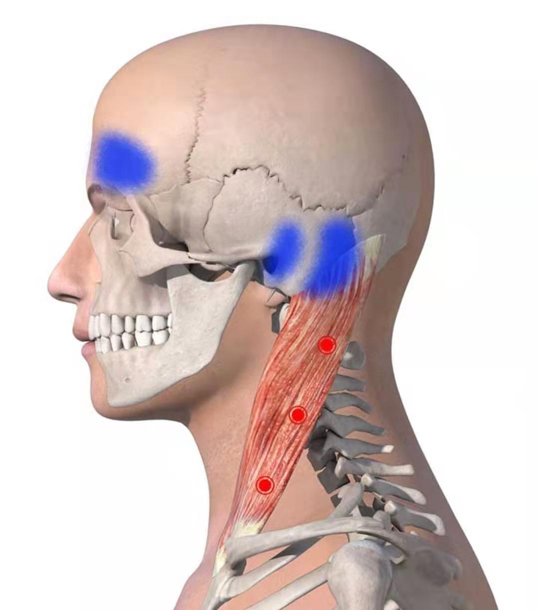 他有颈椎病，头痛，像戴着紧箍咒，一个老头教他头画“凤凰”……