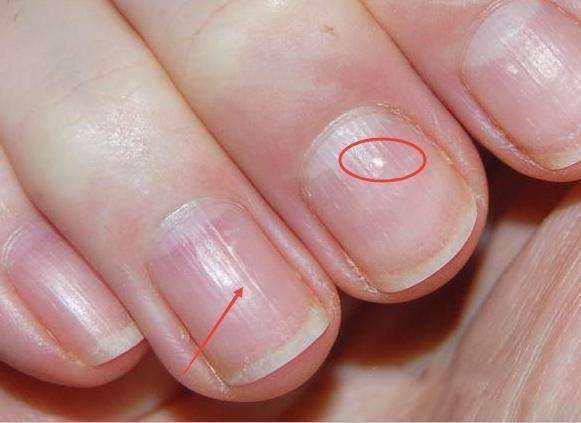 怎样保养指甲？看完这篇，纤纤玉手不是梦