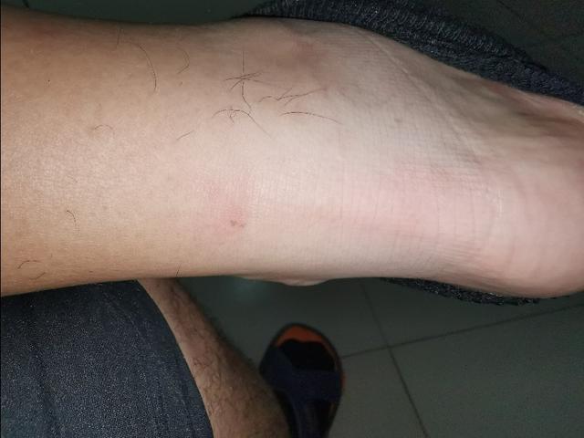 罗斯10玫瑰10年配色,玫瑰10年篮球鞋