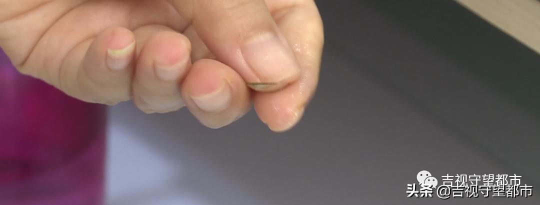 睡眠戴眼罩治疗近视是不是骗人,角膜塑形镜对近视的作用