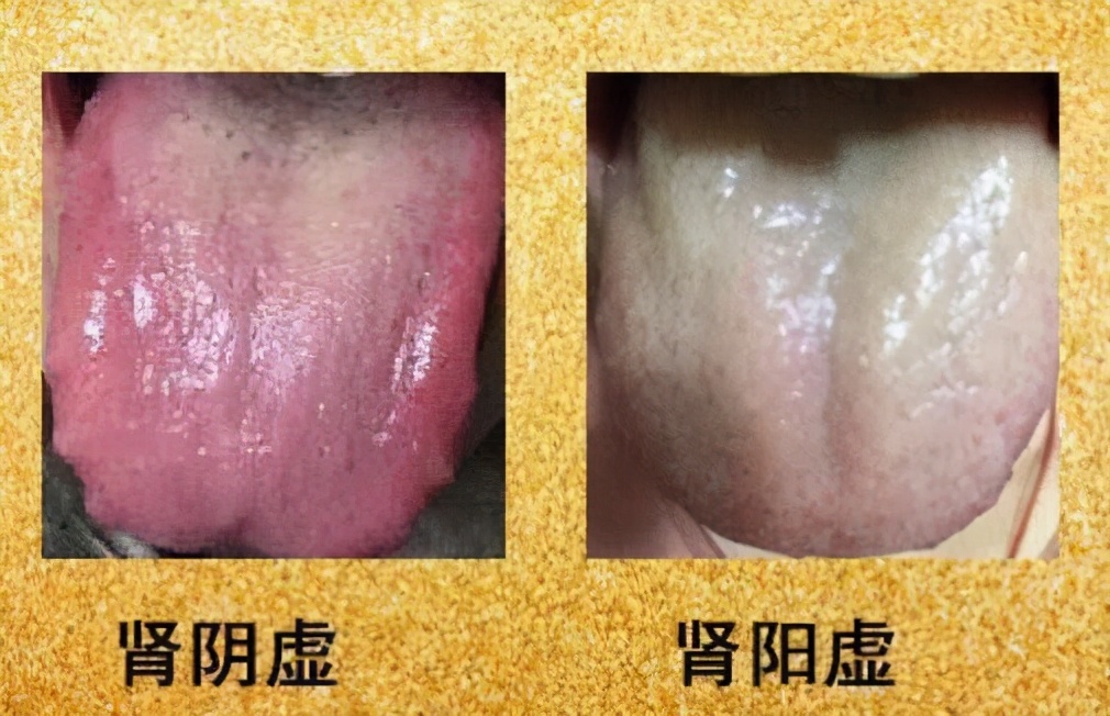 长期吃六味地黄丸对身体有何影响,长期吃六味地黄丸的危害