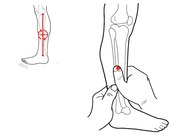 舌苔厚腻微黄中间有裂纹有红点,宝宝舌苔厚白嘴里有味怎么处理