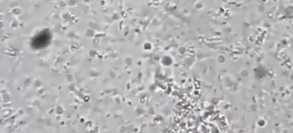 显微镜看肚脐眼里的泥,用显微镜放大肚脐眼里面的泥