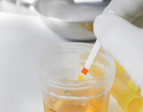 iga肾病四级一般可以控制多少年,我与肾癌斗争的经历