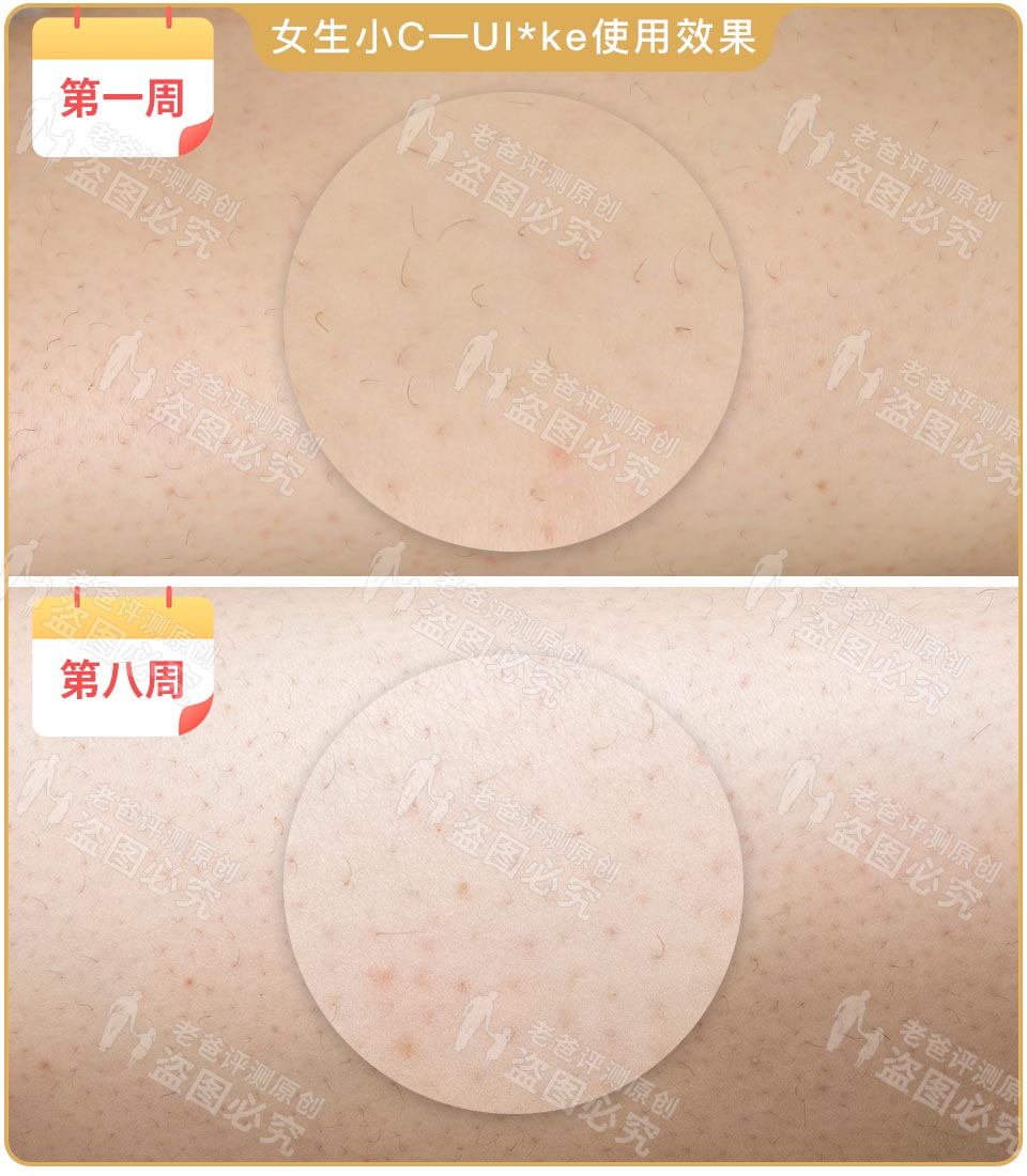 最真实的脱毛仪,bequeen脱毛仪实测