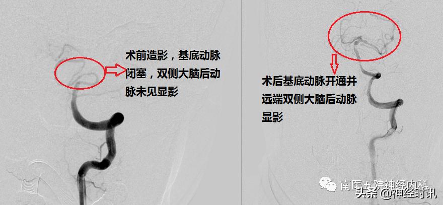 经常头晕不要以为是小问题,不能忽视的短暂头晕