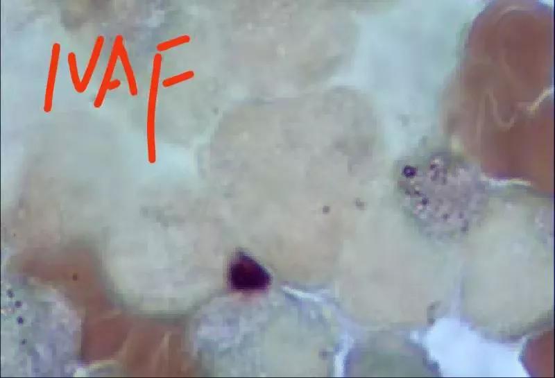 粒单不决问组化?有时还真不一定...