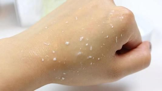 面部角质层薄去角质产品推荐,角质层太薄肌肤耐受性和抵御力