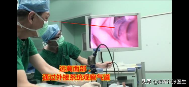 Airtraq氧瞬得，气管插管的最佳解决方案！