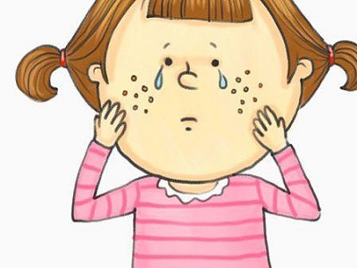 嘴唇下巴长痘痘的原因怎么消除,嘴唇上长痘痘最快消除方法