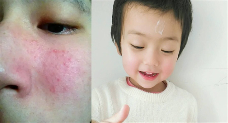 宝妈儿童面霜检测,宝妈测评面霜