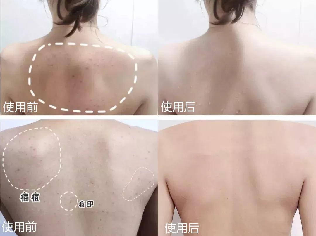 去角质的搓澡巾,加厚去角质搓澡巾