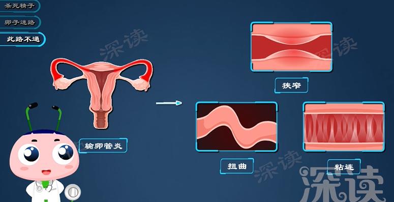 没有白带下腹痛会是附件炎吗,小腹胀痛有白带有妇科炎症吗