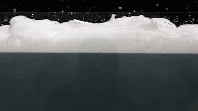 便便时被溅到水怎么办,碰到屎了用水可以洗干净吗