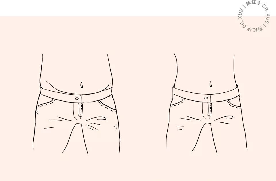 无痕双眼皮大概要多少钱,无痕双眼皮闭眼有痕