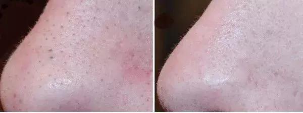 蜂蜜加白醋怎么使用效果好,蜂蜜加白醋的吃法一定要知道