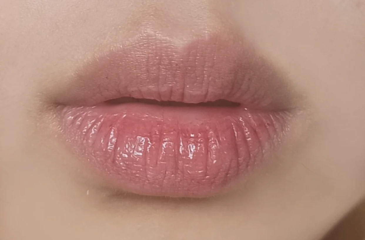 嘴唇经常又干又起皮是什么原因,嘴唇黑紫起干皮用什么