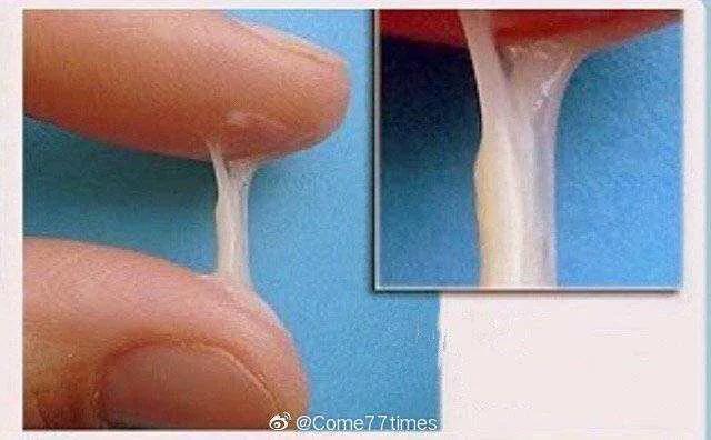 女性白带的危险信号,白带是精子形成的吗
