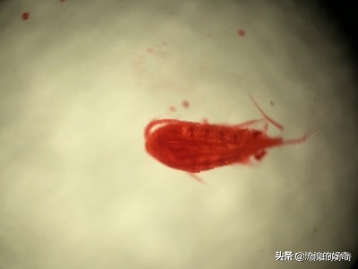 oppofindx3pro显微镜拍螨虫,oppofindx3显微镜可以看螨虫吗