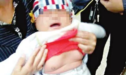 2岁女孩胸部发育成10岁，家长注意了！这些容易造成性早熟