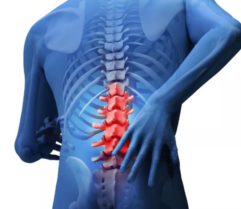 腰间盘突出别发愁记住3个技巧,专家告诉你腰间盘突出该怎么解决