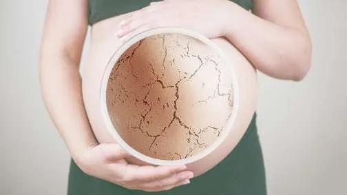 网上卖的妊娠纹修复霜真的有用吗,预防妊娠纹涂的是智商税吗